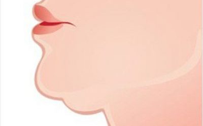 Options for getting Rid of a Double Chin