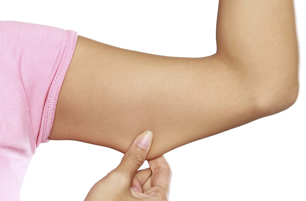 I Had a Bilateral Extensive Brachioplasty 5 Weeks Ago…