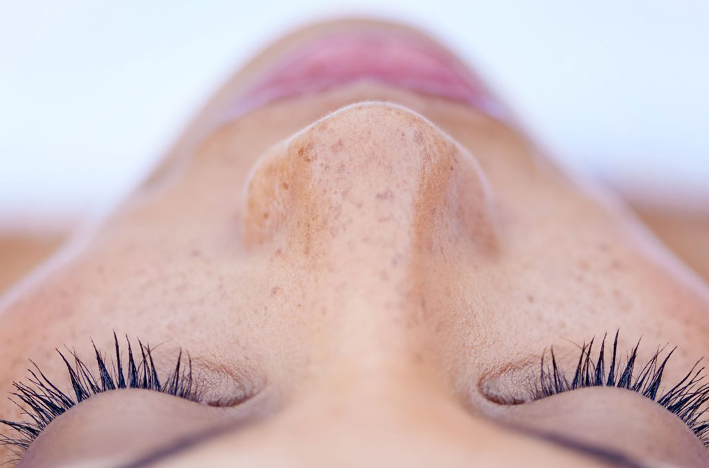 Would the Single Procedure of Alarplasty Work Well for my Nose?