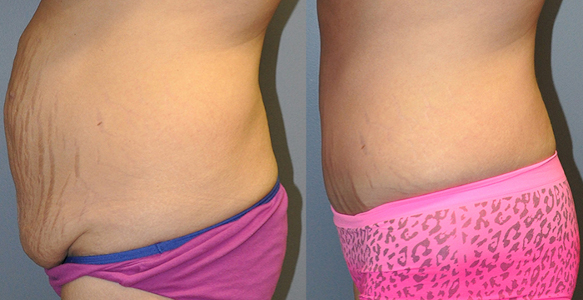 Empowering choices: Path to weight loss