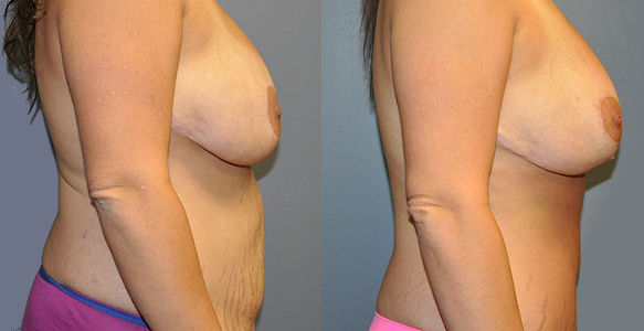 Crafting a healthier future: Weight loss progress