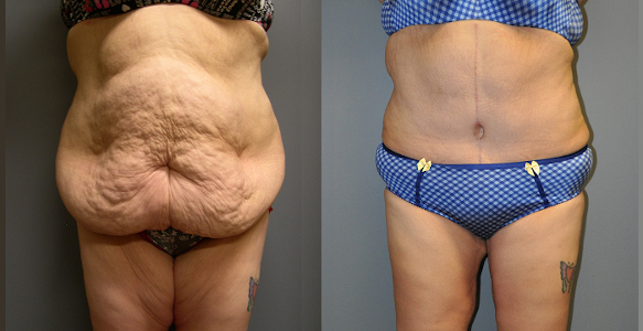 Radiant transformations: Weight loss success