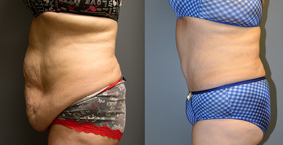 Shaping a new you: Weight loss achievement