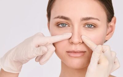 Rhinoplasty: What You Need to Know